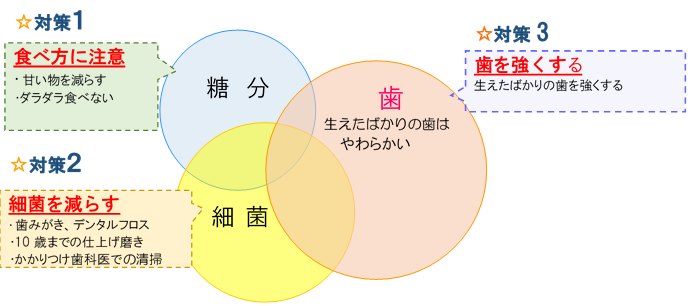 虫歯の要因と予防